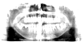Aurel Rückner: 'teeth, mine', © 2012